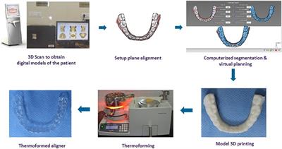Integrated manufacturing of direct 3D-printed clear aligners
